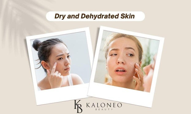 Two women examining dry, flaky patches on their cheeks under a Dry and Dehydrated Skin heading